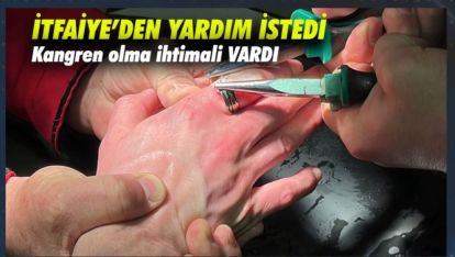 İTFAİYE SPİRAL YARDIMI İLE ÇIKARTABİLDİ